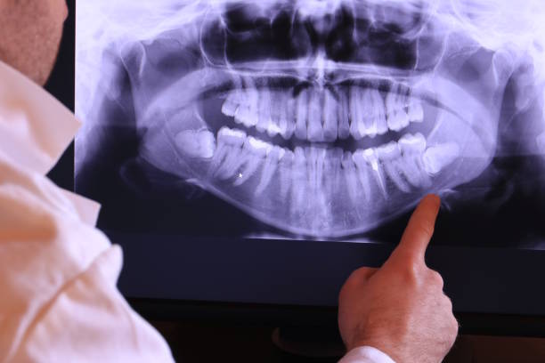 Best Emergency TMJ Treatment in Kimberly, ID