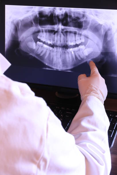 Best Emergency Tooth Extraction in Kimberly, ID