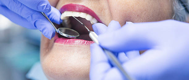 Best Emergency Treatment for Dental Infections or Abscesses in Kimberly, ID